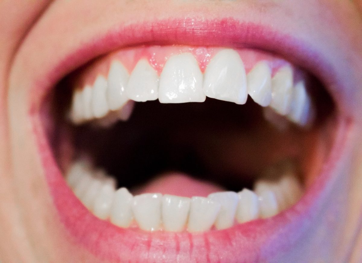 Dzisiejsza technika stosowana w salonach stomatologii estetycznej może sprawić, że odbierzemy śliczny uśmiech.